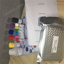人 KIAA1199 elisa酶聯(lián)免疫試劑盒品牌